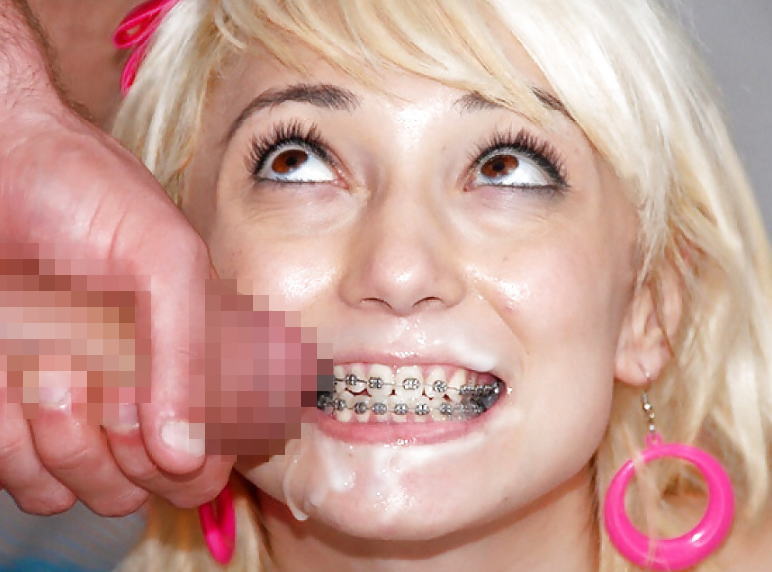 歯列矯正器具 外国人 口腔 フェチ エロ画像