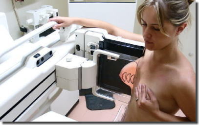 乳がん検診をはじめおっぱいや肛門を検査しているエロ画像 ②