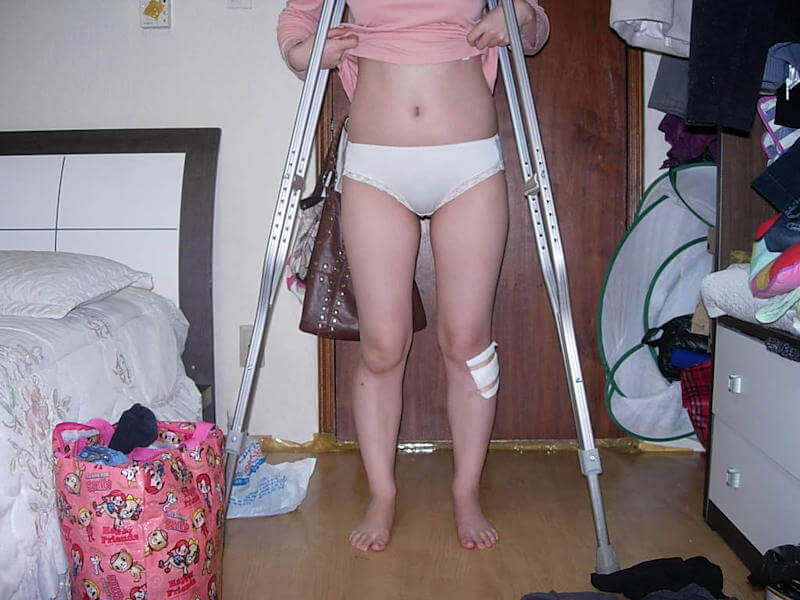 脚を怪我した松葉杖女子のエロ画像 