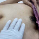下腹部を診察するエロ画像